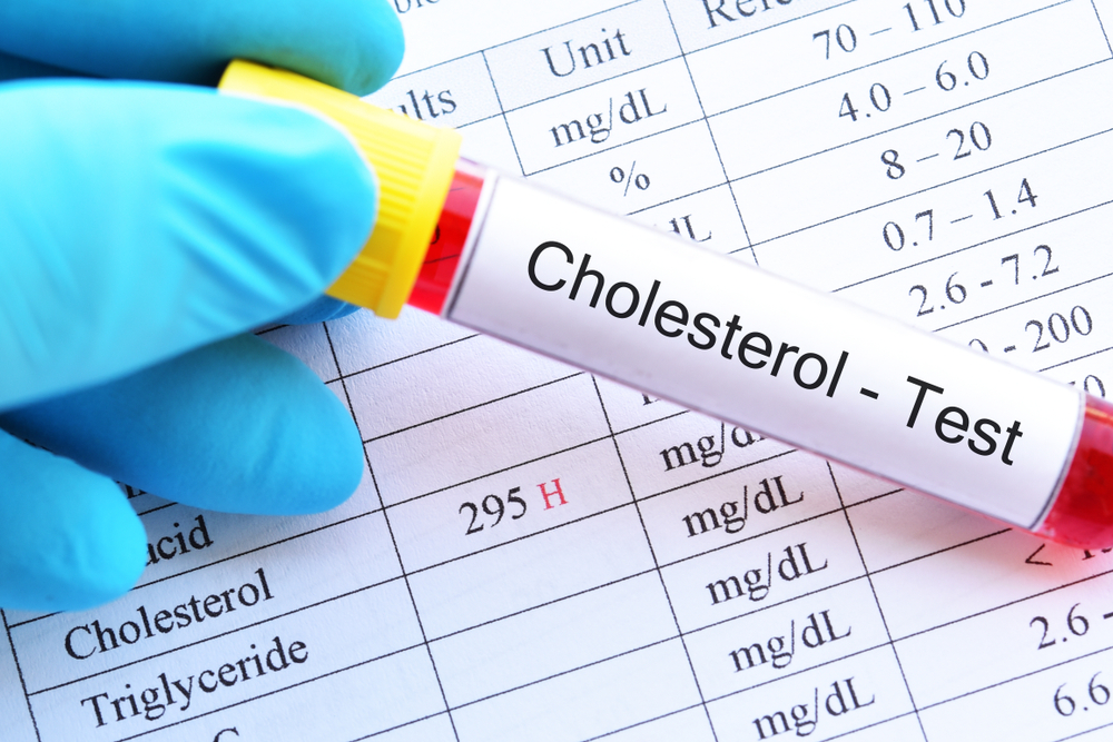 Counting Cholesterol How Often Should You Check Your Levels SLMA